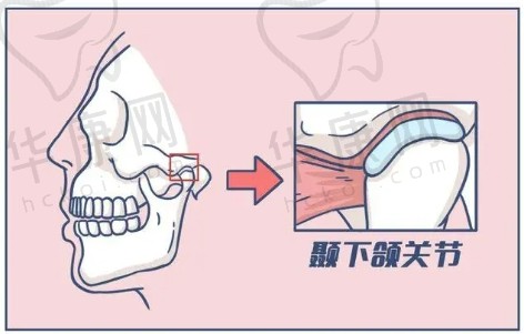 下颌关节疾病