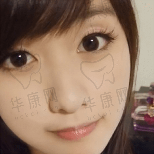 螳螂