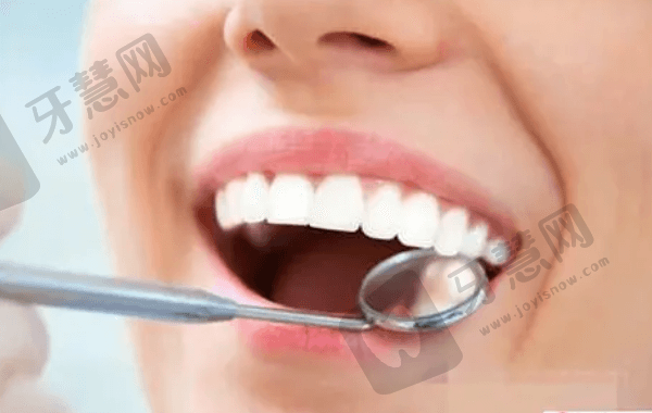 深圳美莱口腔超薄贴面推荐医师余斌
