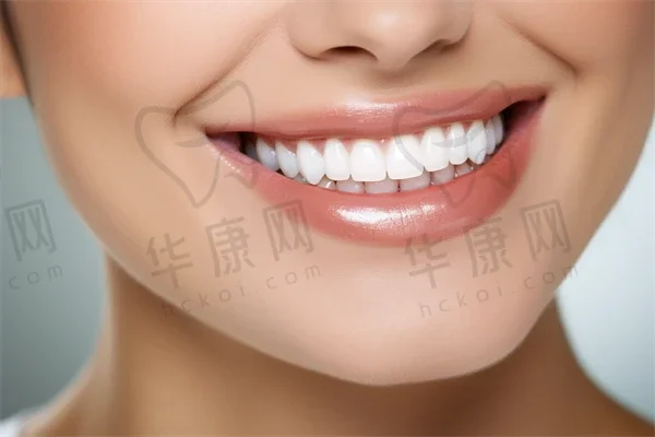 进口陶瓷自锁矫正的优势及适合人群