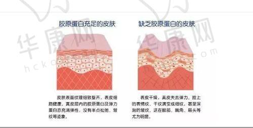 瞿健医生擅长项目