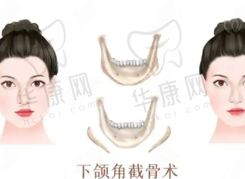 张建英医生特色技术优势