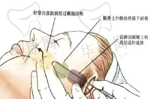 瞿健医生预约方式