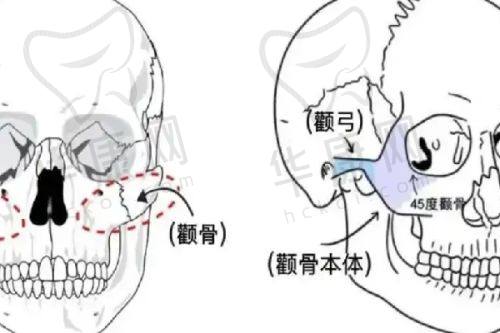 珠海韩妃医疗美容周国伟医生特色技术优势