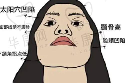 南宁芭芘丽医疗美容严飞医生的口碑评价