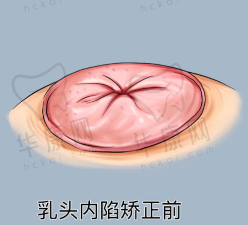 济南韩氏整形外科医院宋世鹏医生预约方式