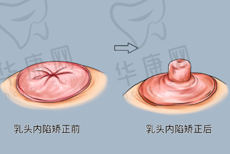 南宁芭芘丽医疗美容严飞医生预约方式