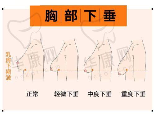 北京华韩医疗美容医院黄旭培医生的口碑评价
