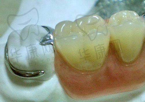 成都西南口腔医院其他口腔项目