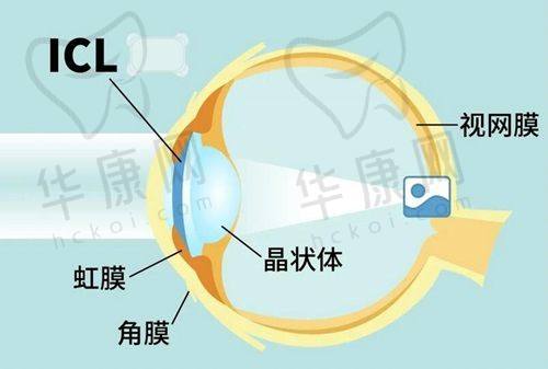 深圳深北爱尔眼科医院