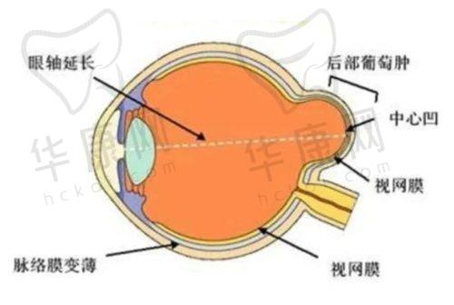 悦瞳眼科属于什么档次？高端连锁品牌，技术、服务、公益全方位对标爱尔眼科