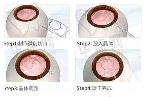 宜昌华厦眼科医院的服务理念与特色