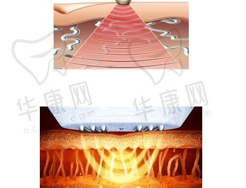 南京鼓楼美莱夏建军曼托假体隆胸2万起，专利技术打造自然饱满美胸！