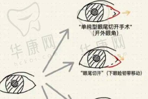 哈医 大二院美容科整形常见问题解答