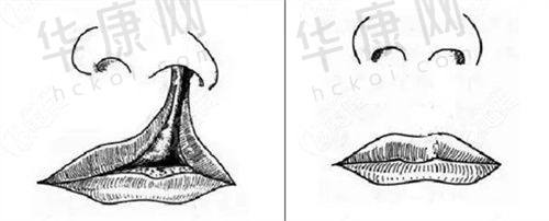 淄博天丽整形美容医院王东平医生的口碑评价