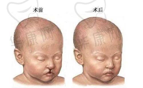 成都米兰柏羽医学美容医院