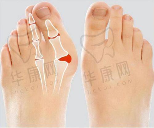 找北京蒂凡妮医疗美容王志坚做馒化修复真不错，术前垮脸术后紧致秒变颜值天花板