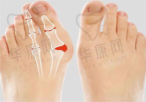 北京华韩整形医院的价格与口碑