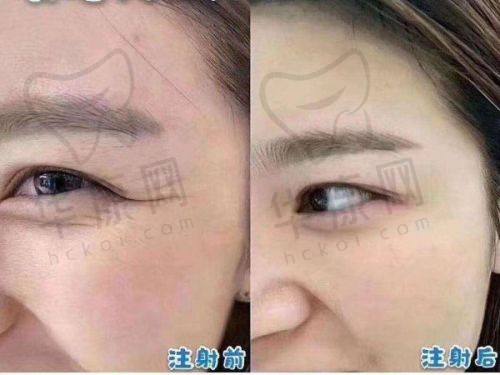 淄博天丽整形医院的口碑与评价
