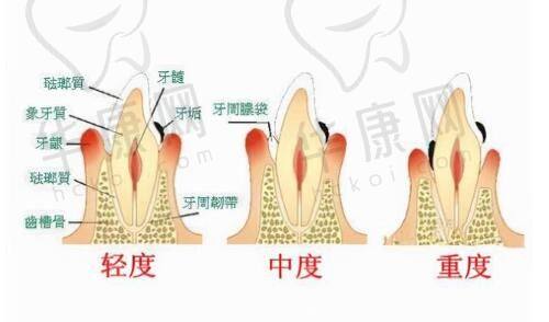 兰州时光激光整形美容医院的手术细节