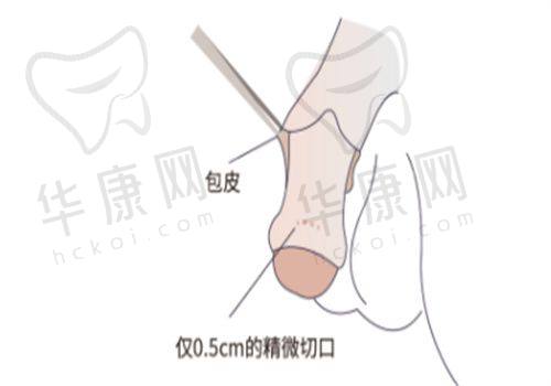 西安画美医疗美容医院杨春梅医生特色技术优势