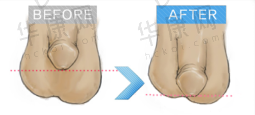 西安画美鼻部整形价目与特色
