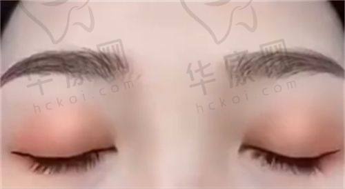 北京华韩整形医院的热门项目