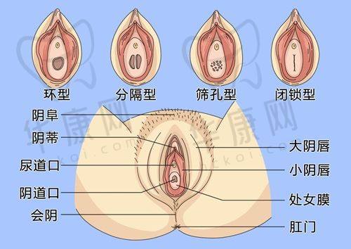 南京鼓楼美莱医疗美容夏建军隆胸真人案例分享：从自卑到自信，美胸蜕变太惊艳！