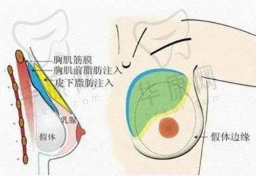 西安画美医疗美容医院张沙沙医生预约方式