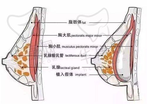 西安画美医疗美容医院王仁根医生特色技术优势