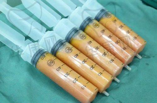 身边人的反馈与自信提升