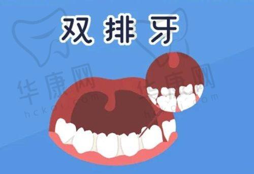 全口吸附性义齿复诊情况