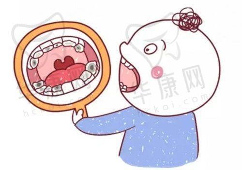 半口种植牙收费情况如何？