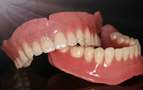 北京约康口腔在时代天使隐形矫正方面的医院优势