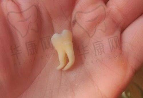 沈阳京科医院口腔科赵茗菲医生特色技术优势