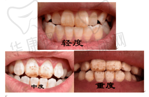 沈阳京科医院口腔科赵茗菲医生擅长项目