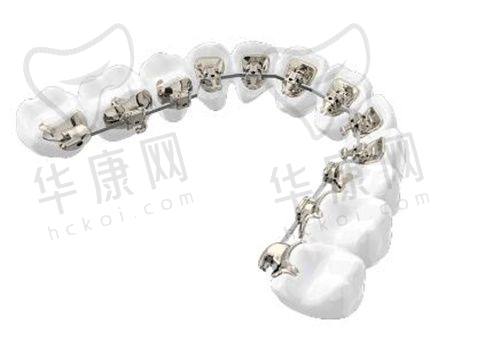 北京松鼠家口腔韩玮玮隐适美隐形矫正45000元起，专业定制开启美牙新体验