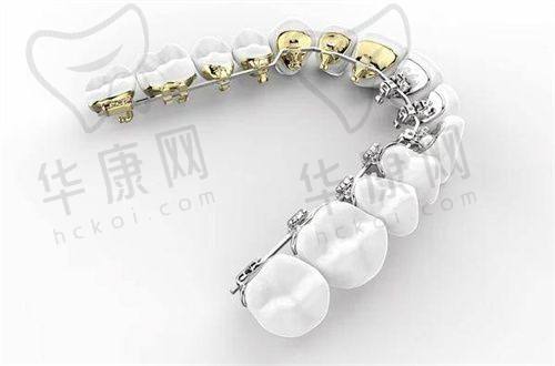 北京松鼠家口腔韩玮玮隐适美隐形矫正的服务优势