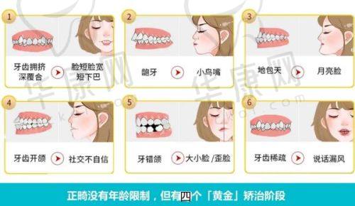 清华阳光口腔隐形矫正类收费及特点怎样?