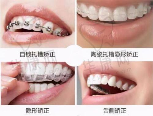 牙友们如何享受商丘美迪牙科的优惠呢？