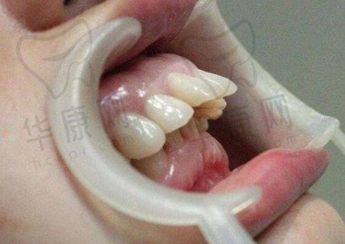 深圳穗华口腔公交路线有哪些？