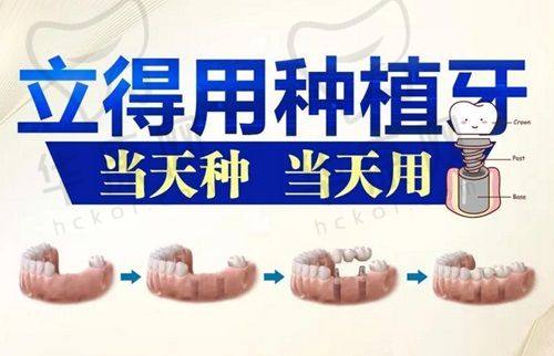 长春正德口腔种植牙之患者评价