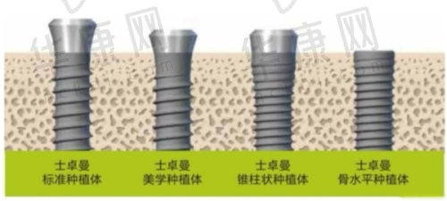 溧水瑞齿固德口腔的患者评价及成功实例
