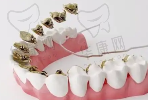 如何选择适合自己的深圳种植牙医院？