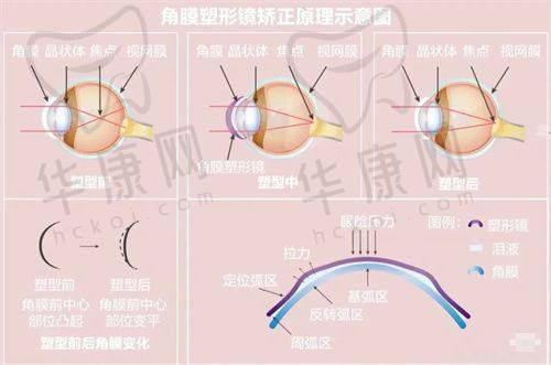 沈阳爱尔眼科总院区这么好，你准备什么时候去呢？