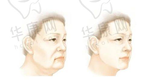嘉兴韩辰医疗美容门诊部价格