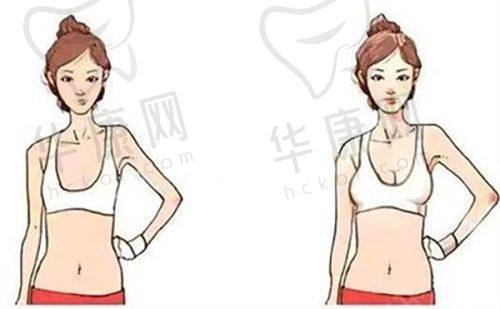 上海伯思立医疗美容倪锋医生擅长项目