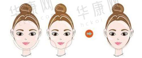 哈医 大二院美容科有哪些特色项目？