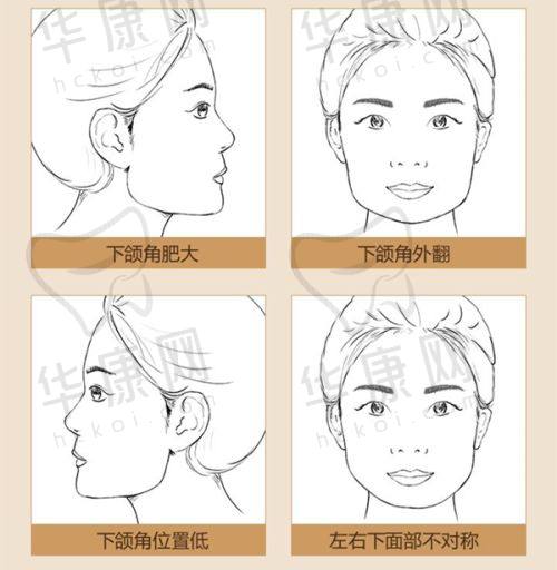 北京蒂凡妮医疗美容郭栋鼻部整形注重细节与美学平衡