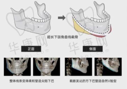 李希军 医生的技术优势总结